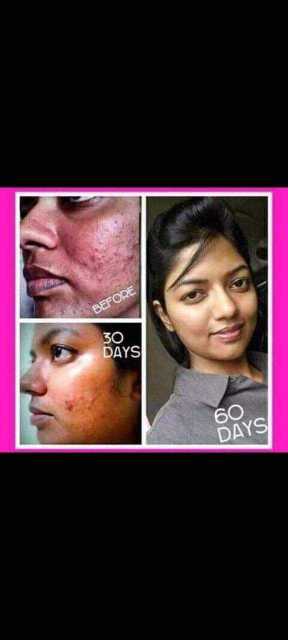 Herbalife skin booster,  all types skin problem solution